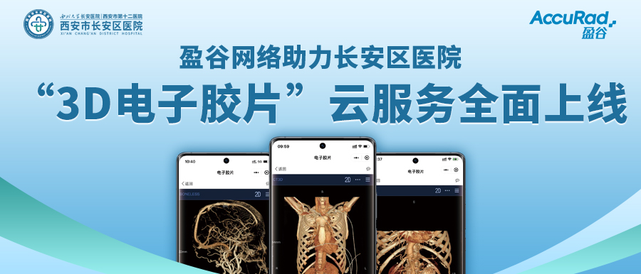 盈谷網(wǎng)絡(luò )助力長(cháng)安區醫院“3D電子膠片”云服務(wù)全面上線(xiàn)！診斷結果、影像資料隨時(shí)隨地看！